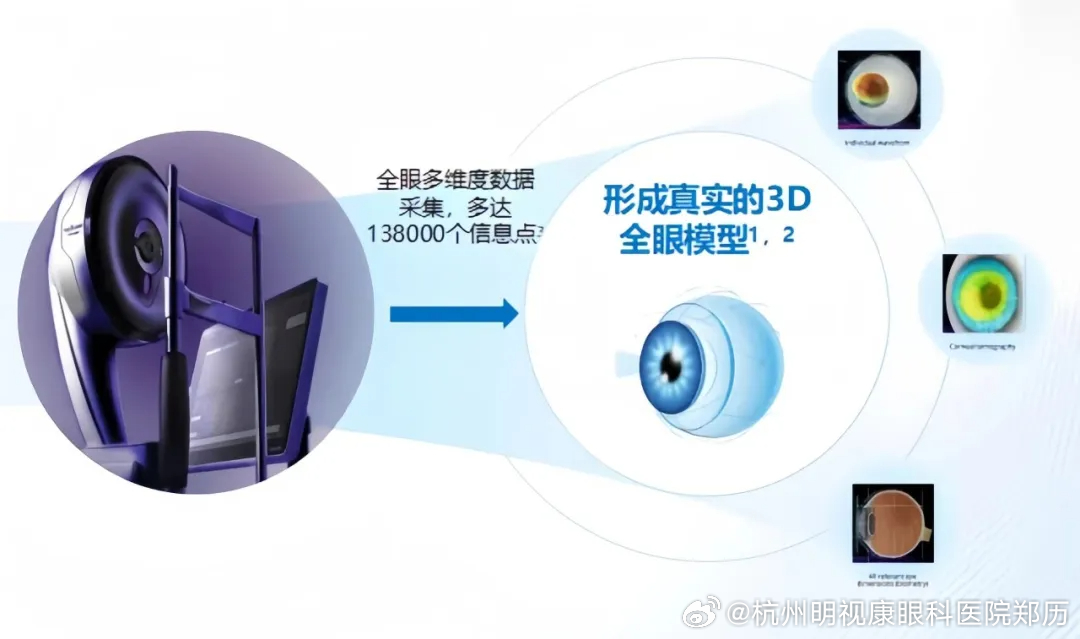 前沿视界：揭秘尖端近视矫正最新技术突破